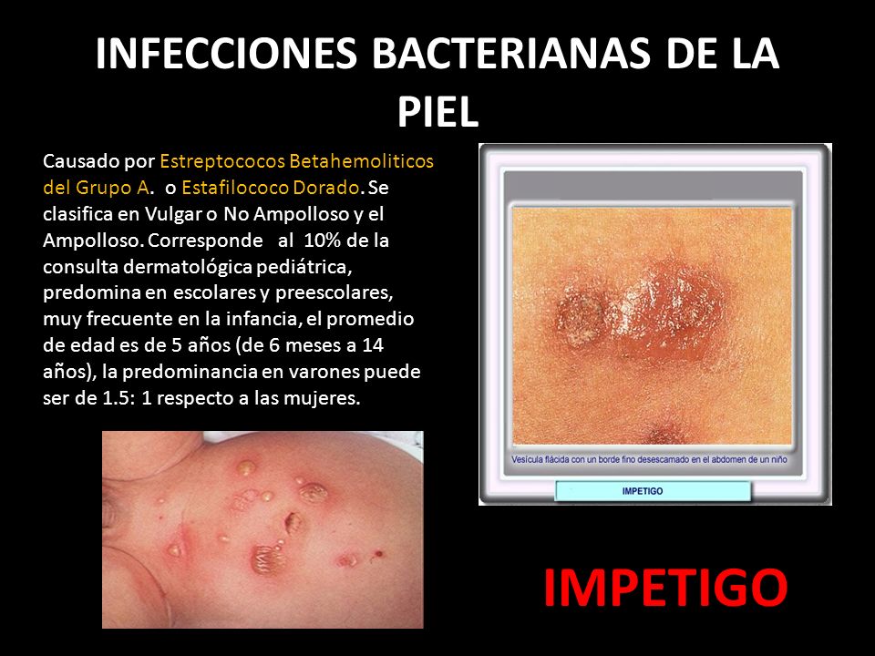 infección estafilocócica de la piel